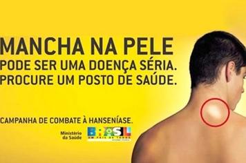 Prorrogada a entrega de senhas para inscriÃ§Ã£o em programas habitacionais